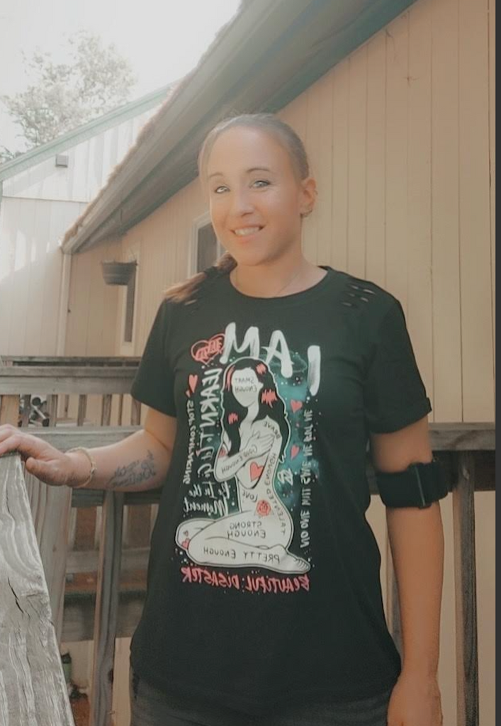 Shanna's Story: We Are All Here For Each Other